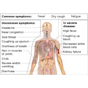 Disinfection Duncanville Services